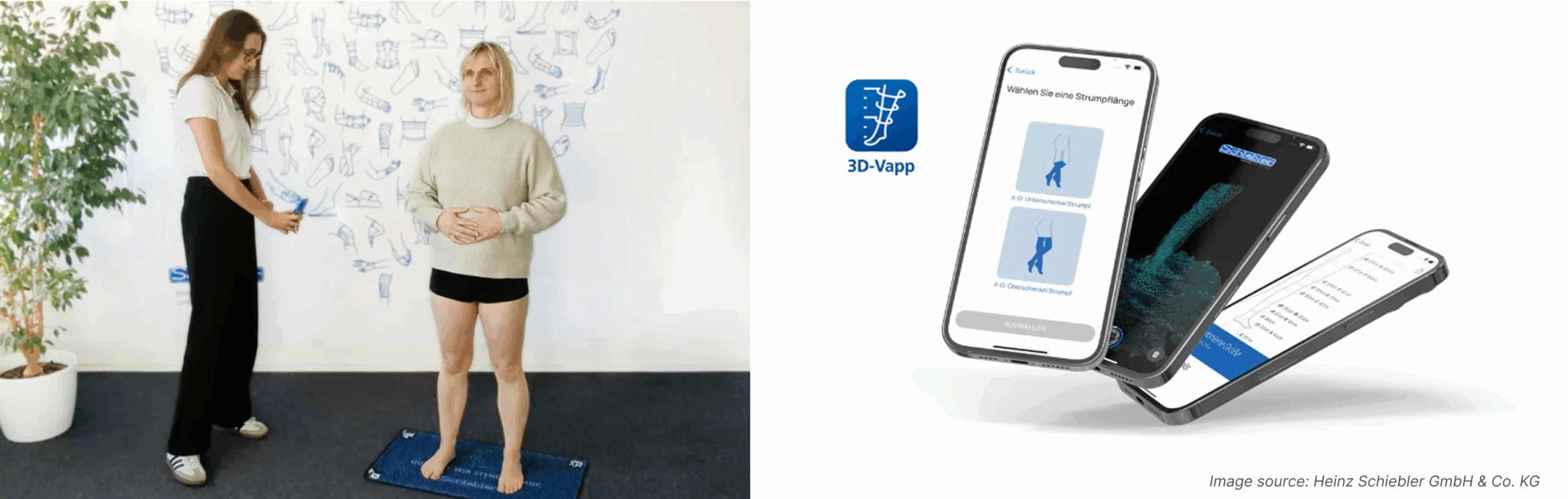 Schiebler 3d leg measuring app