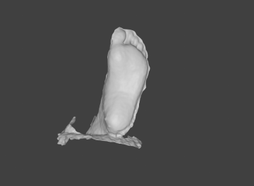 3d foot plantar scan